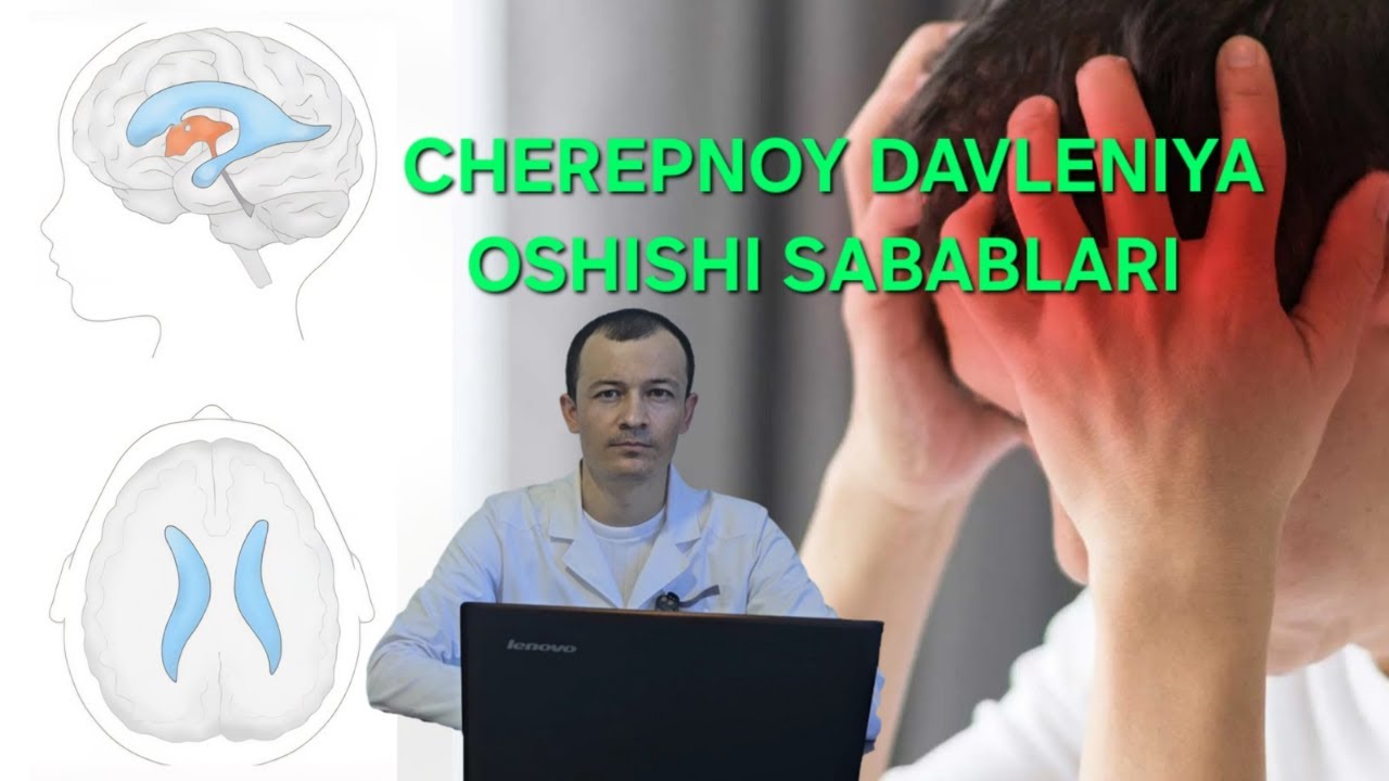 CHEREPNOY DAVLENIYA OSHISHI #mardonbekgafurov