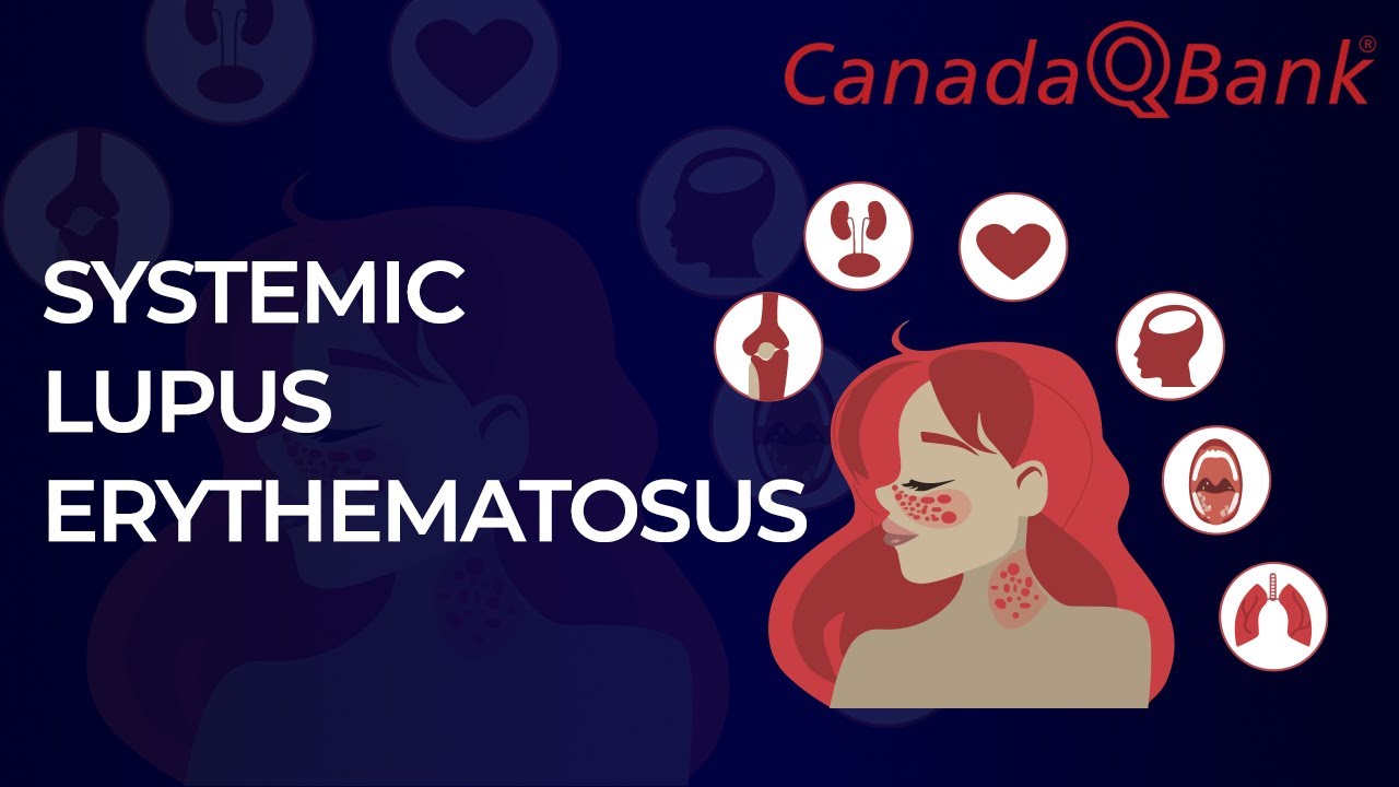 Systemic Lupus Erythematosus Explained | Diagnosis, Antibodies & Management | CanadaQBank