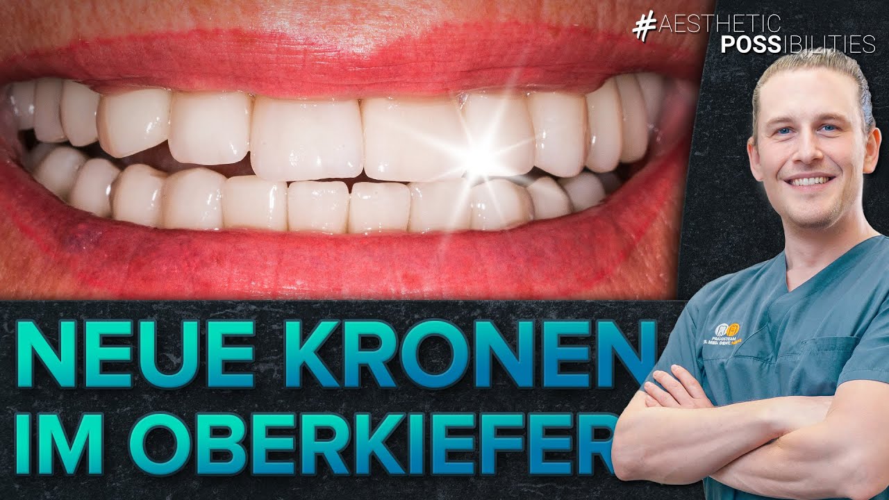 Kronenerneuerung - Vollkeramik im Oberkiefer | Freshup einer Patientin