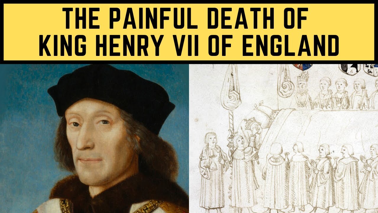 The PAINFUL Death Of King Henry VII Of England