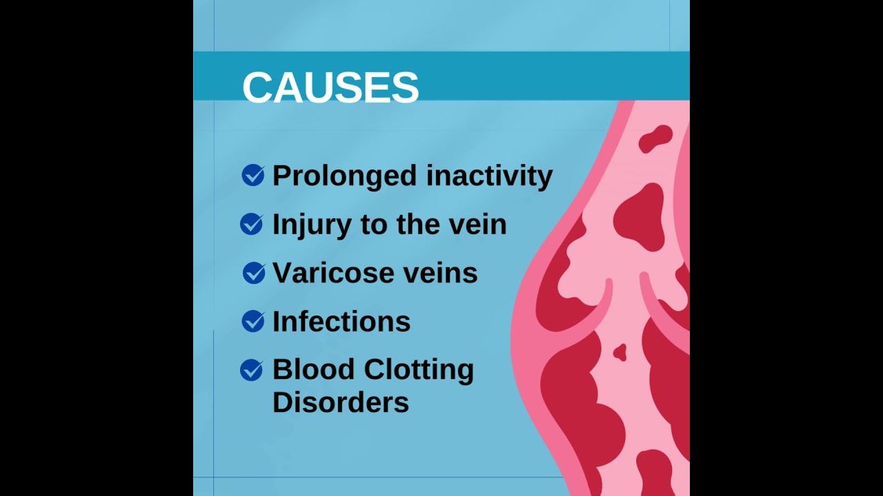 Understanding Superficial Thrombophlebitis - Causes, Symptoms, and Management
