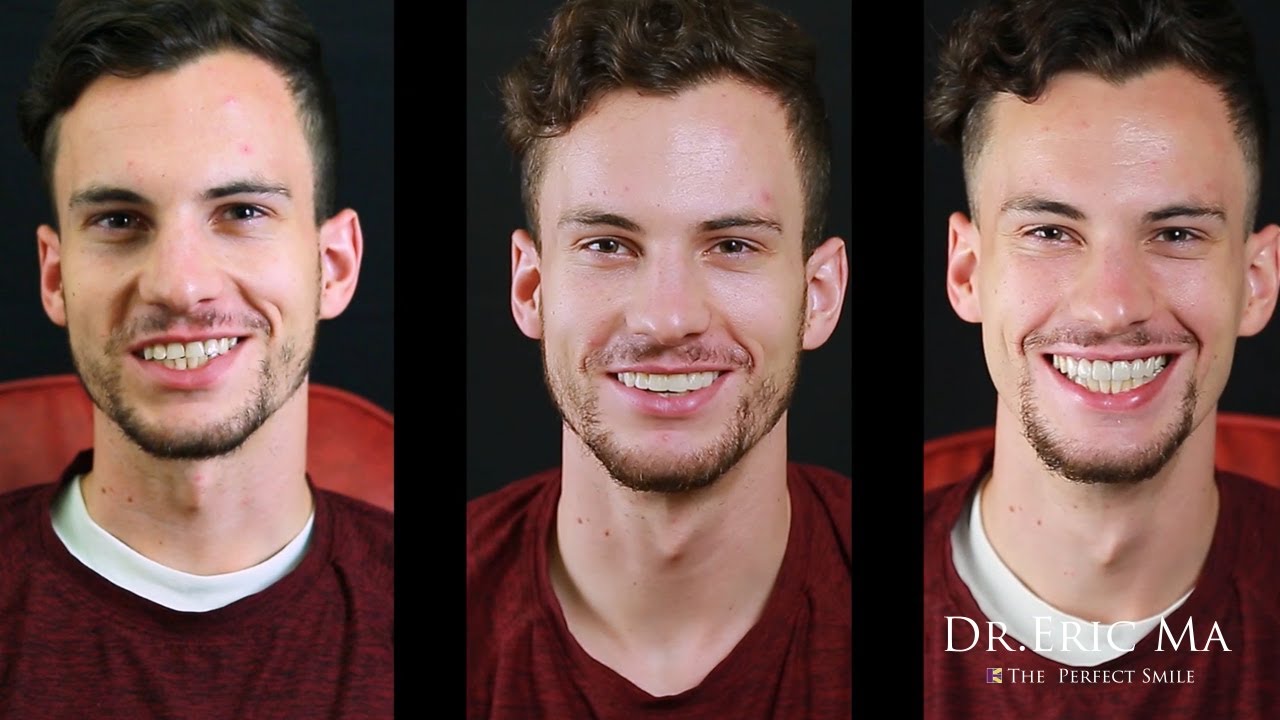 Dr. Eric Ma 馬永昌醫師 | 擺脫逆境與壓力帶來的咬合困擾，馬醫師如何協助麥特找回自我價值｜DSD數位微笑曲線設計 | 丰采美學牙醫診所