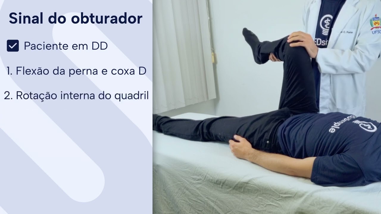 Sinal do obturador - Exame F&iacute;sico do Abdome
