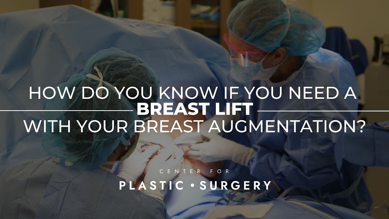 Do You Need a Breast Lift W/ Your Breast Augmentation? Here's How To Know!