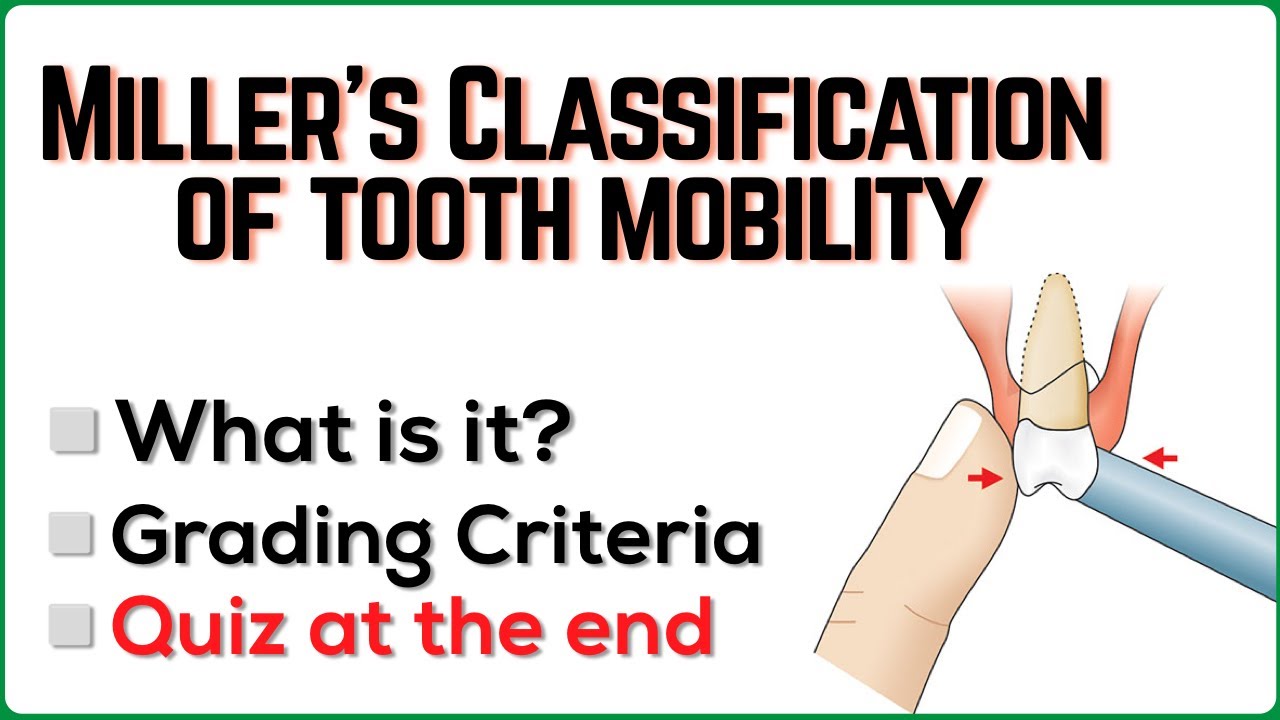 Miller's Classification of Tooth Mobility