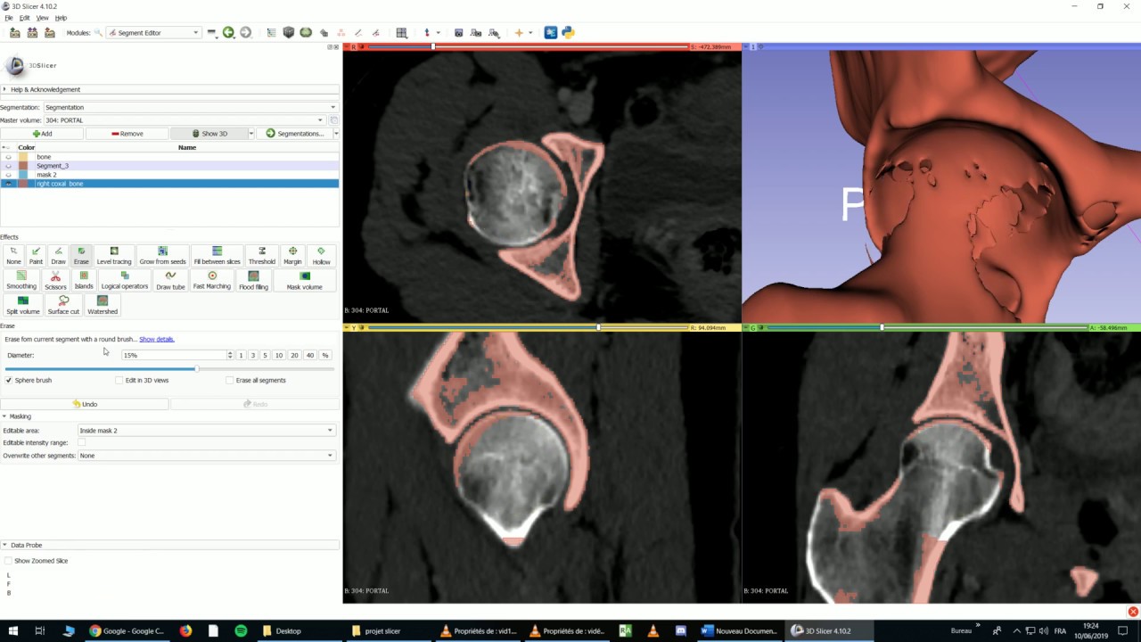 Organ segmentation 1: Bones