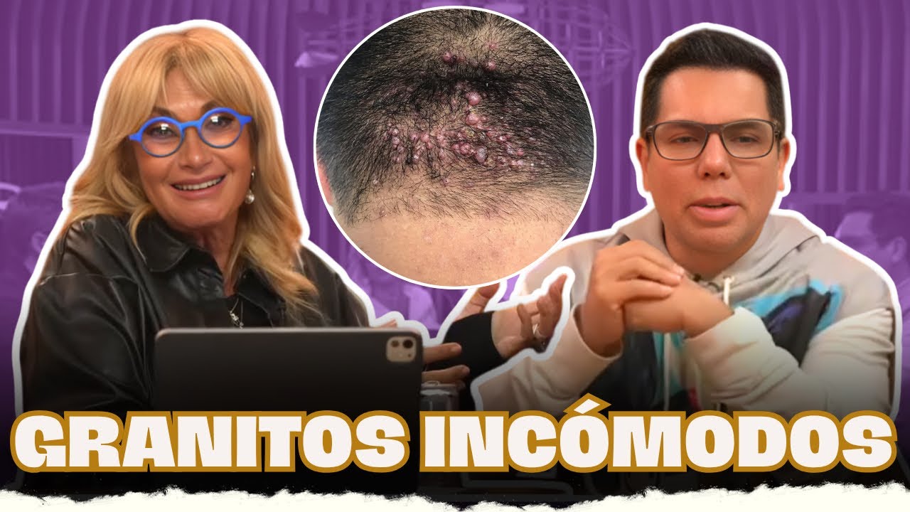 FOLICULITIS en el CUERO CABELLUDO: MOTIVO Y TRATAMIENTO I JAVIER DERMA