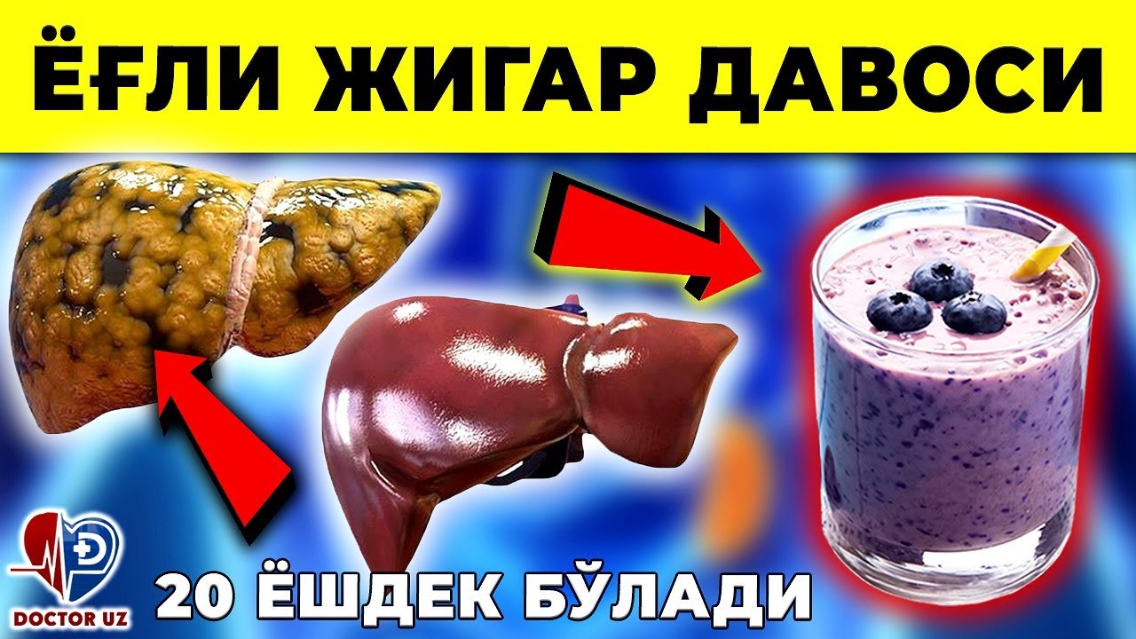 ЁҒЛИ ГЕПАТОЗ! ХАР КУН ИЧИНГ ВА ЁҒЛИ ЖИГАРДАН ХАЛОС БЎЛАСИЗ