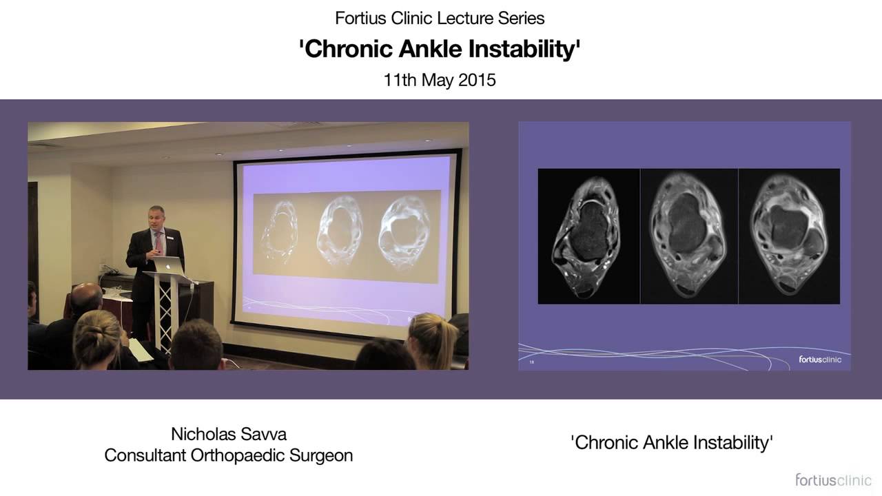 Chronic Ankle Instability