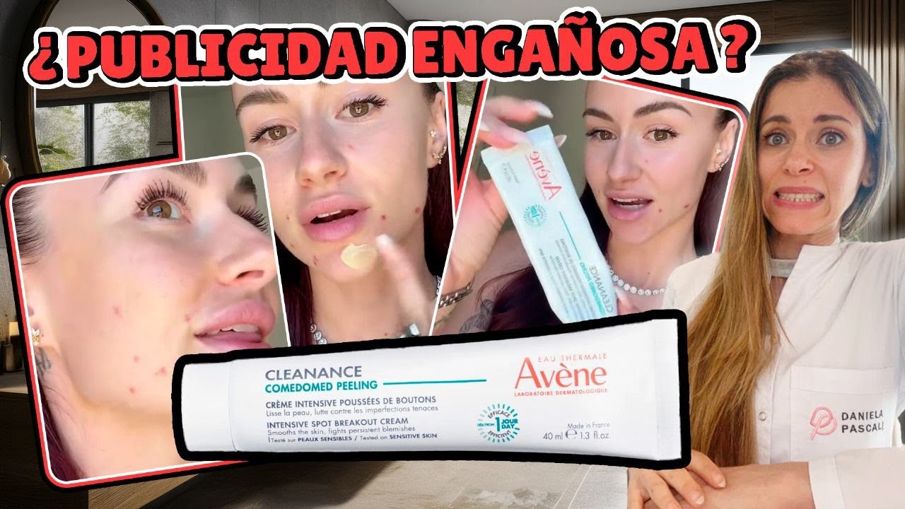 ¡NO COMPRES NADA PARA EL ACNÉ ANTES DE VER ESTO!