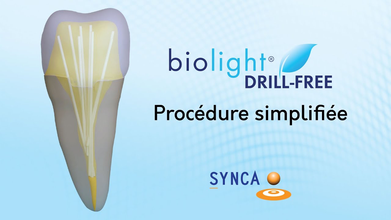 Procédure simplifiée de l'utilisation des Biolight Drill-Free (v2)