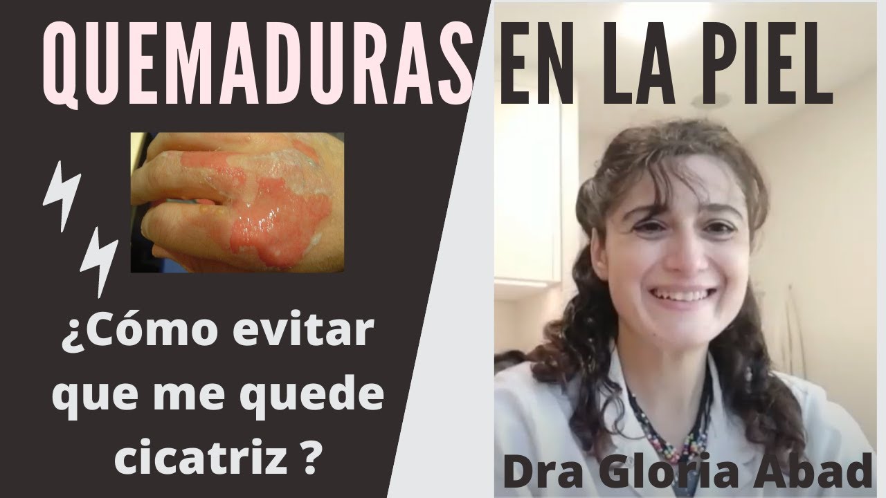 QUEMADURAS  DE PIEL. Consejo de una DERMATÓLOGA.  ¿QUÉ HACER?   🔥  💥  ⚡