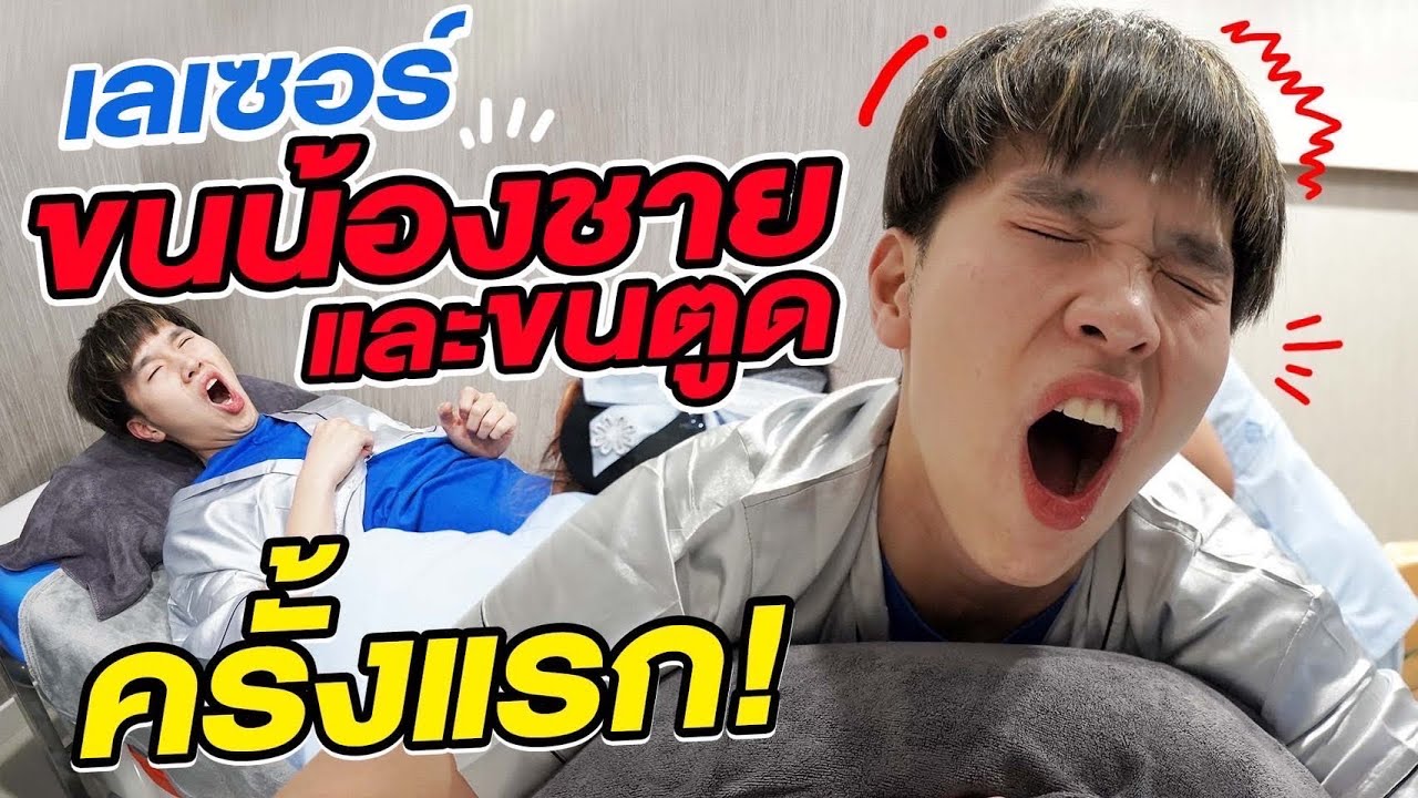 เลเซอร์ขนน้องชาย ครั้งแรกในชีวิต จะเจ็บไหม?