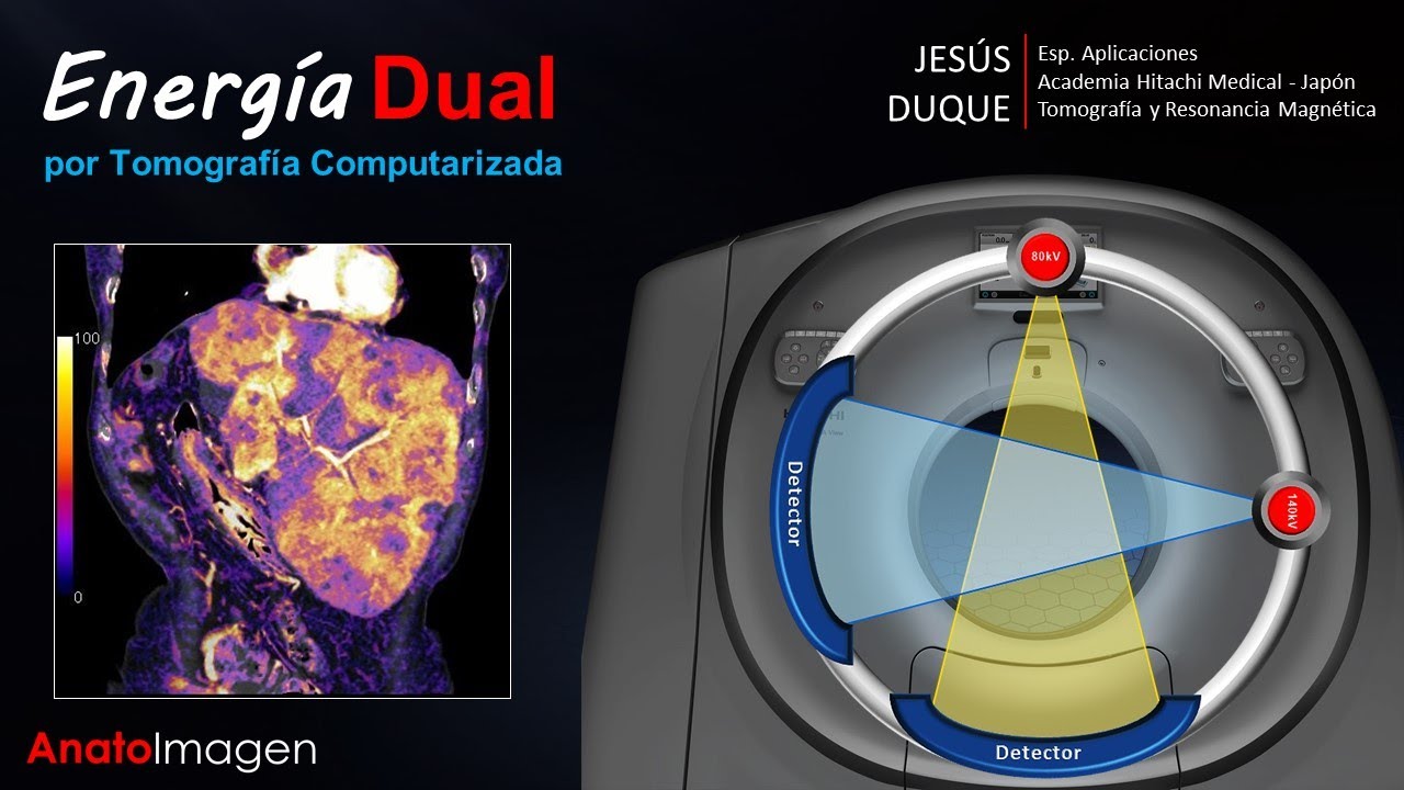 Energía Dual por Tomografía Computarizada, CT-Scan Dual Energy