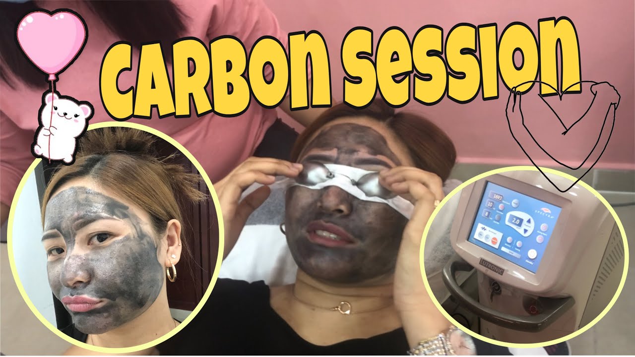 MY CARBON FACIAL LASER SESSION EXPERIENCE #goodforscar #selflove #pampering