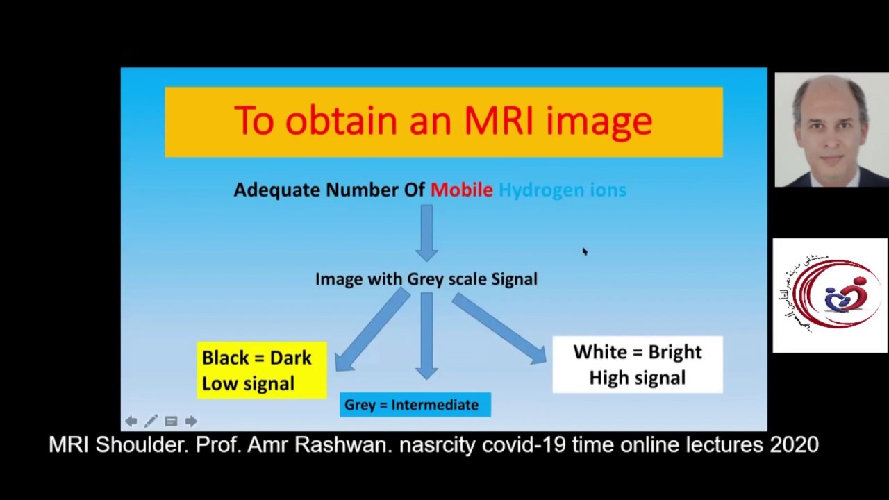 MRI Shoulder. Prof. Amr Rashwan. nasrcity covid19 time online lectures 2020