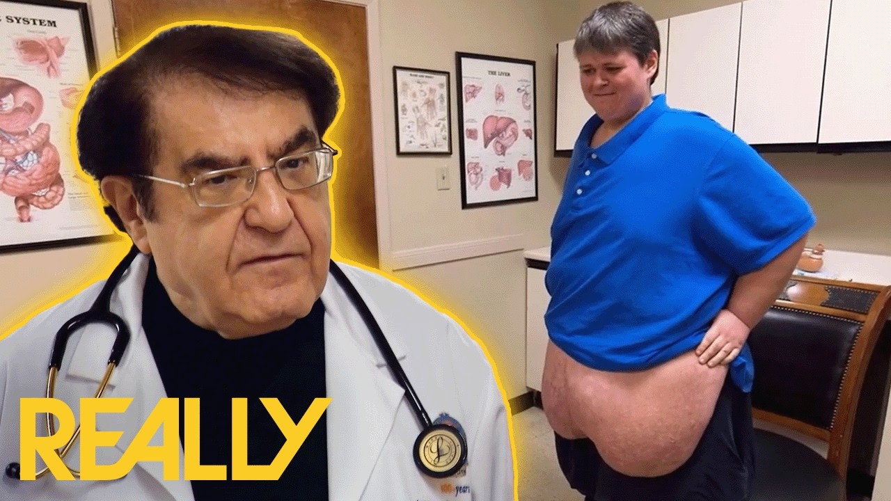 Dr. Now Considers Skin Removal After Joe&rsquo;s 365LB WEIGHT LOSS | My 600-lb Life Where Are They Now?