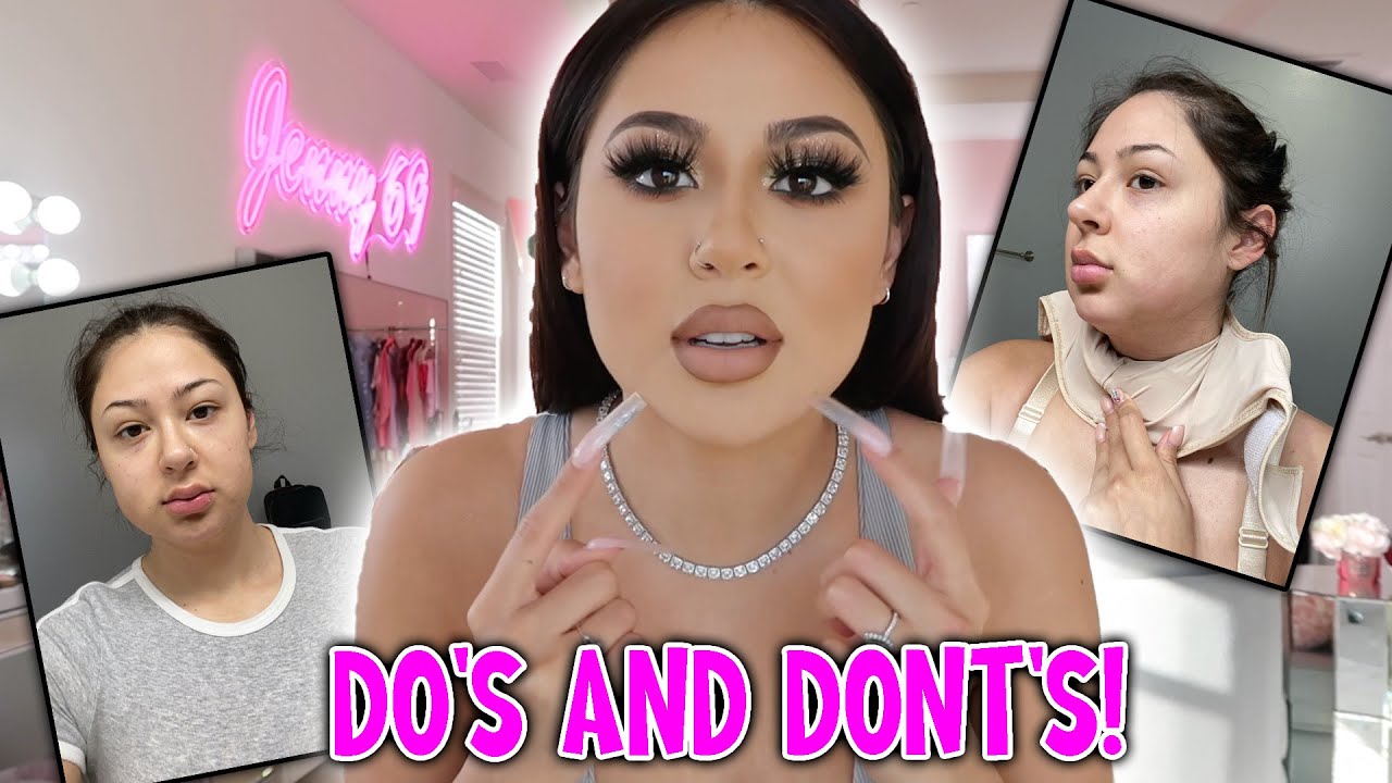 ALL ABOUT MY FACE INJECTIONS!