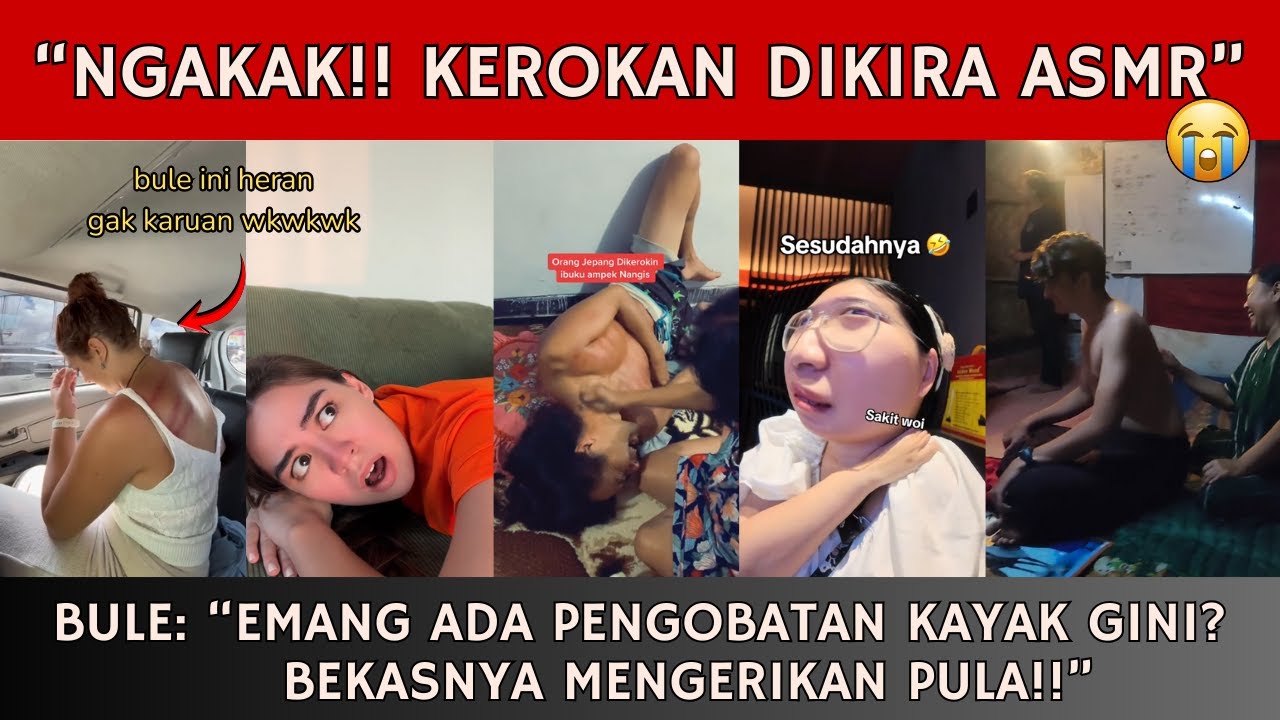 Ngakak!! Bule Kagum Dengan Manfaat Kerokan, Tapi Takut Buat Nyoba