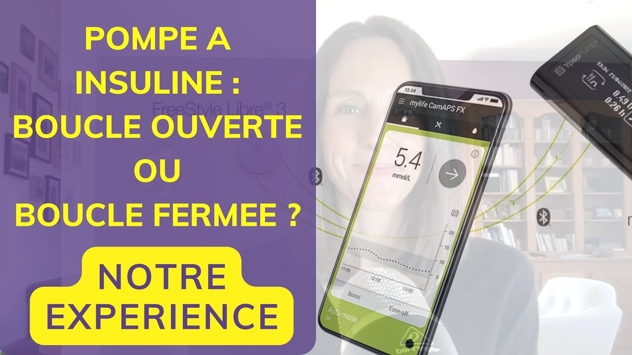 Pompe à insuline en boucle ouverte ou fermée hybride : notre retour d'expérience #diabete