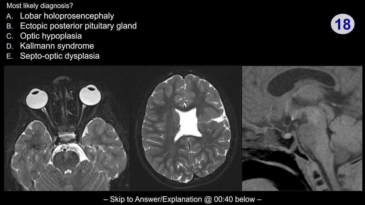 Neuroradiology board review - Pediatric Case 1