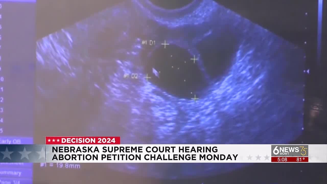 Nebraska Supreme court to hear abortion petition challenge