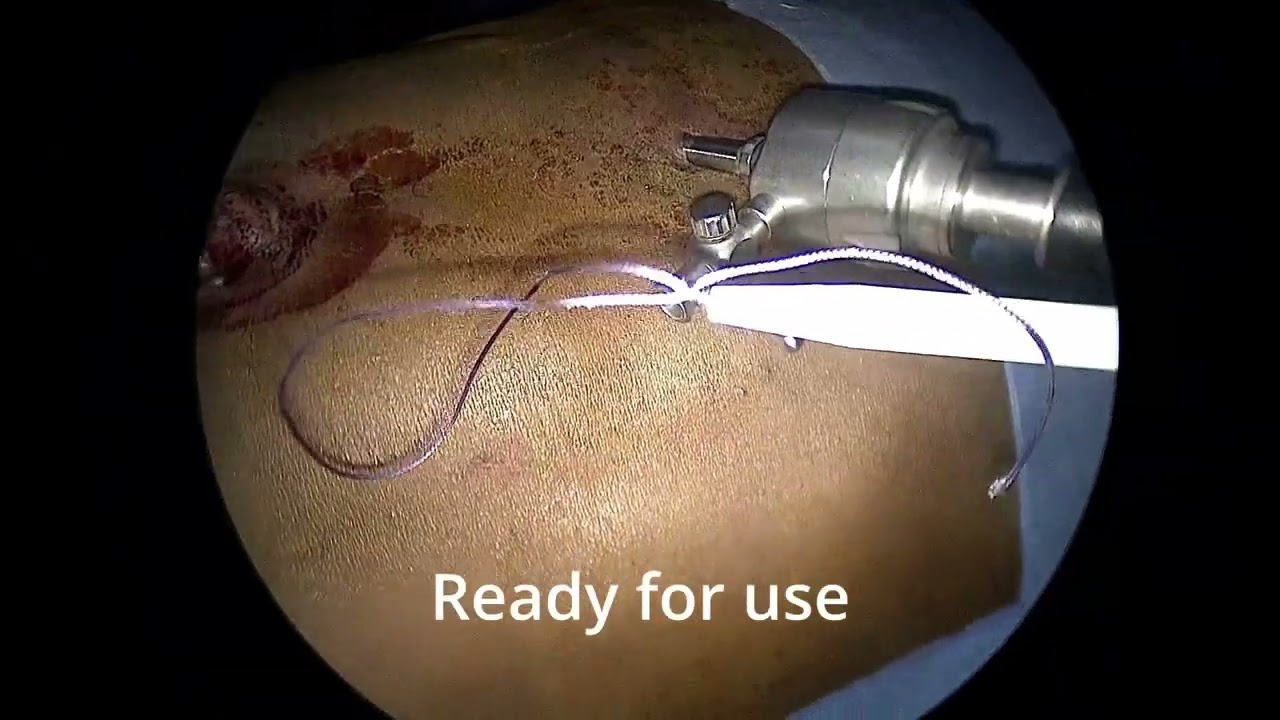 How to Reload 