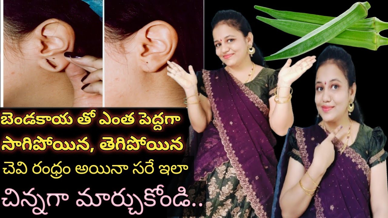 🔥how to shrink Ear👂hole at homeచాలా ఈజీగా పెద్దగా సాగిపోయిన,తెగిపోయినచెవి రంధ్రం చిన్నగా చేసుకోవచ్చు