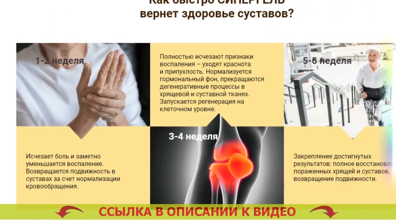 ДИАФЛЕКС ИЛИ АРТРА ЧТО ЛУЧШЕ ⚡ АРТРИТ МАЗЬ ЦЕНА