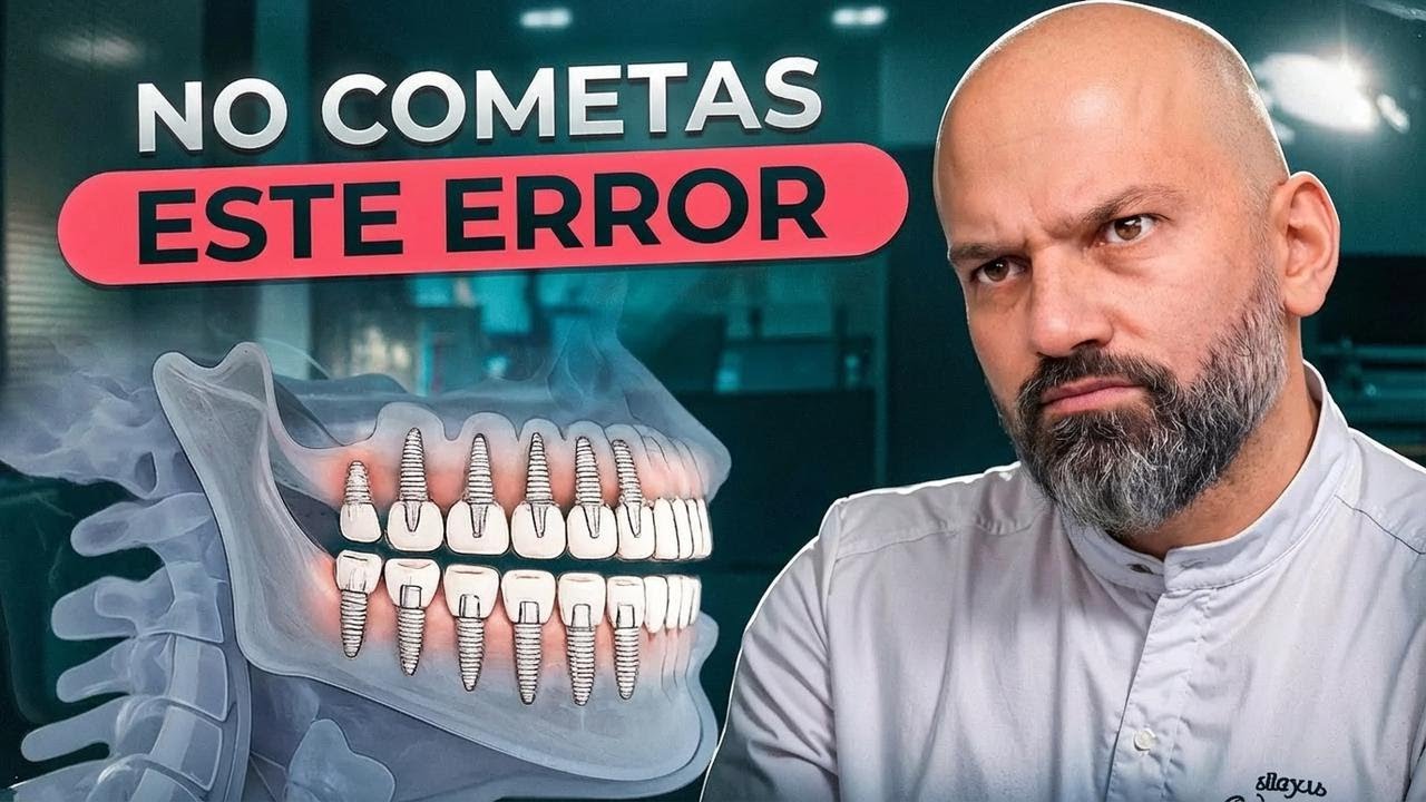 No te saques los dientes, los implantes NO reemplazan a los tuyos