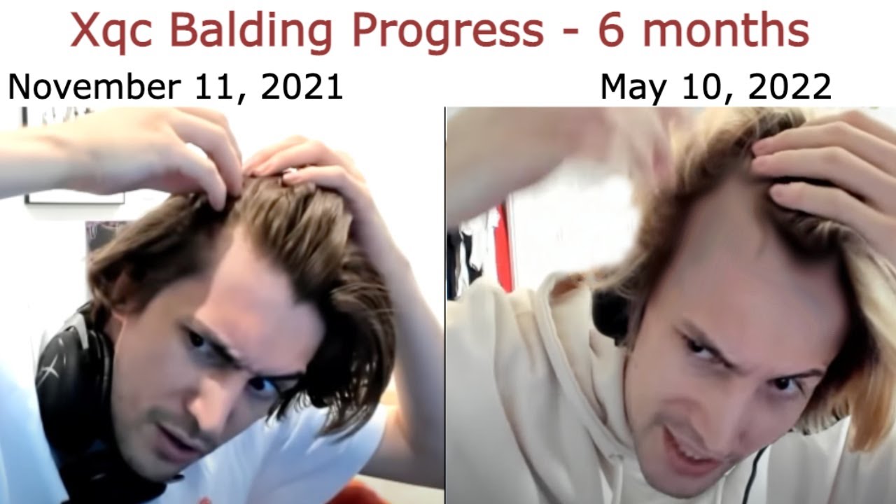 xQc Reacts to Fan-Made Memes | Reddit Recap #241