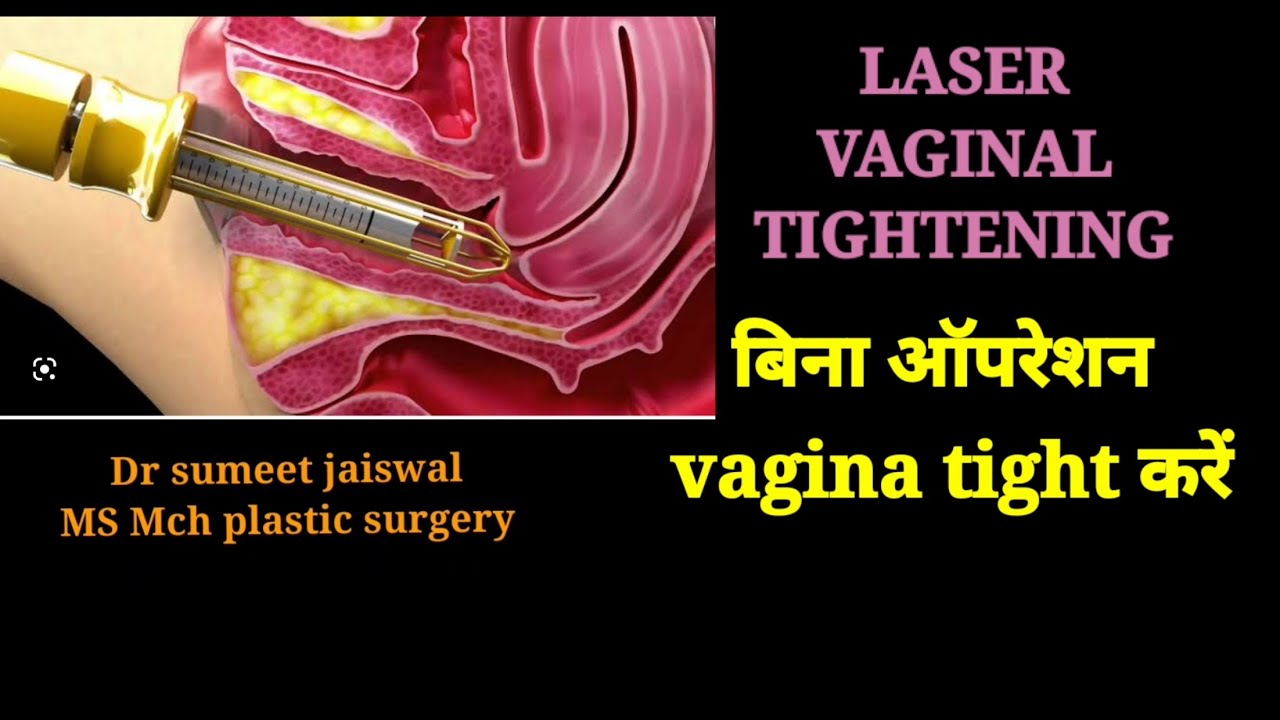 Non surgical vaginal tightening . laser vaginal tightening indore bhopal mumbai ujjain jabalpur