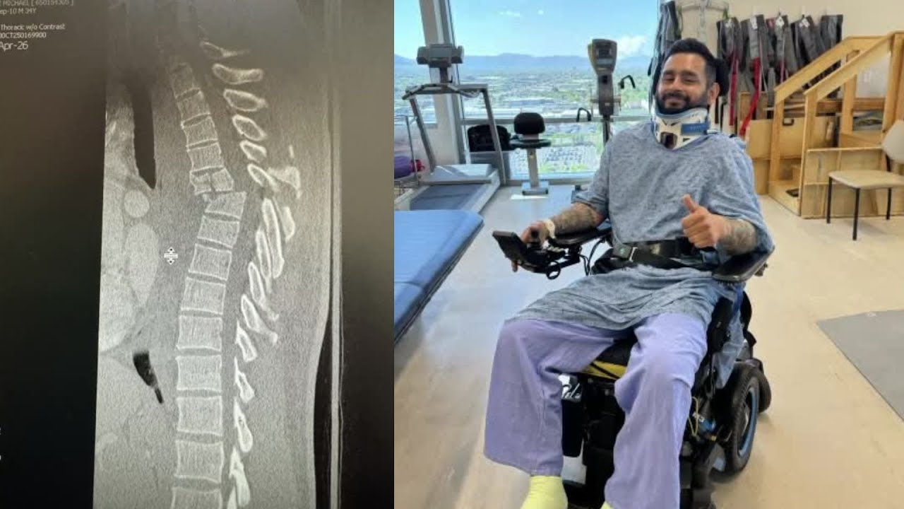 Utah man who suffered massive injuries in motocross accident inspires others with positive attitude