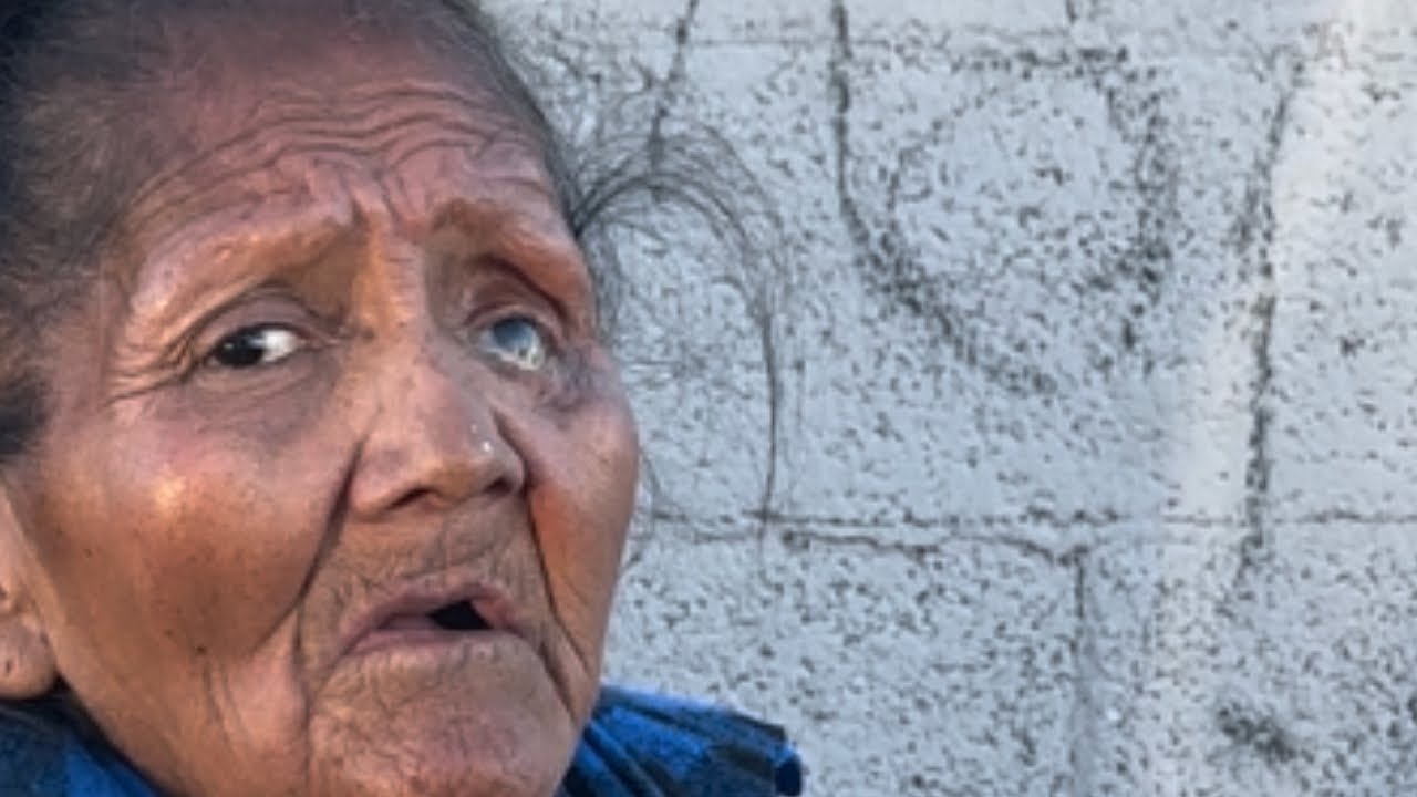 Brenda Is 61 Years Age, Only 1 Eye, Apache