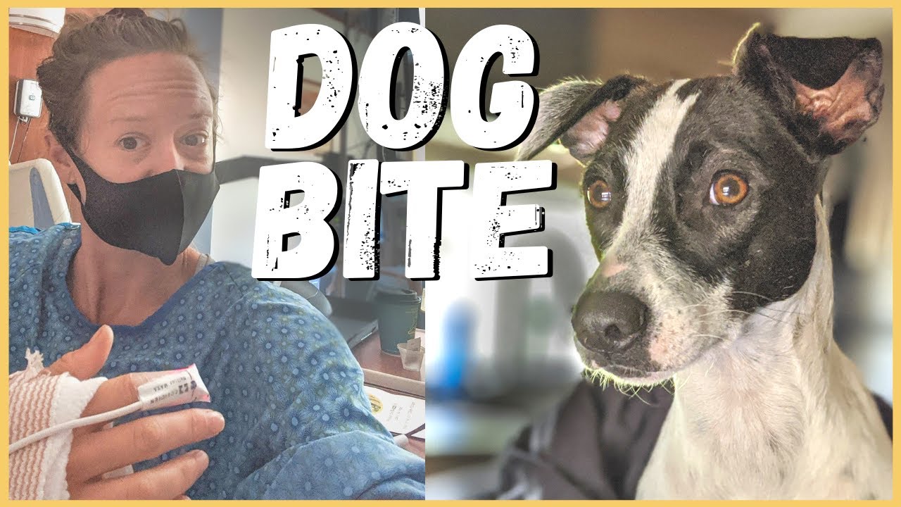 Three Days in the Hospital, Dog Bite from Rescue Dog | Newstates in the States