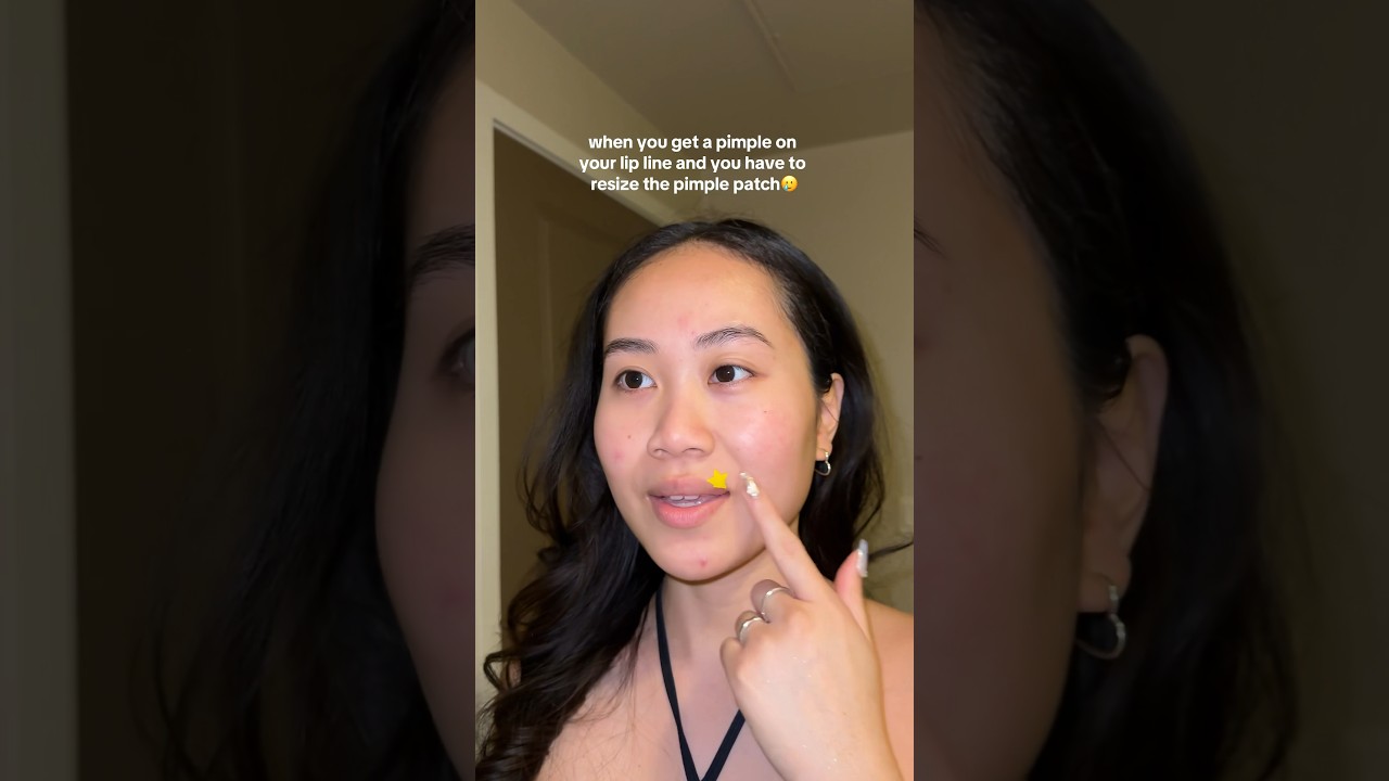 CUSTOMIZING pimple patches for lip line pimples??? 🫠⭐️ #pimplepatch  #acneproneskin