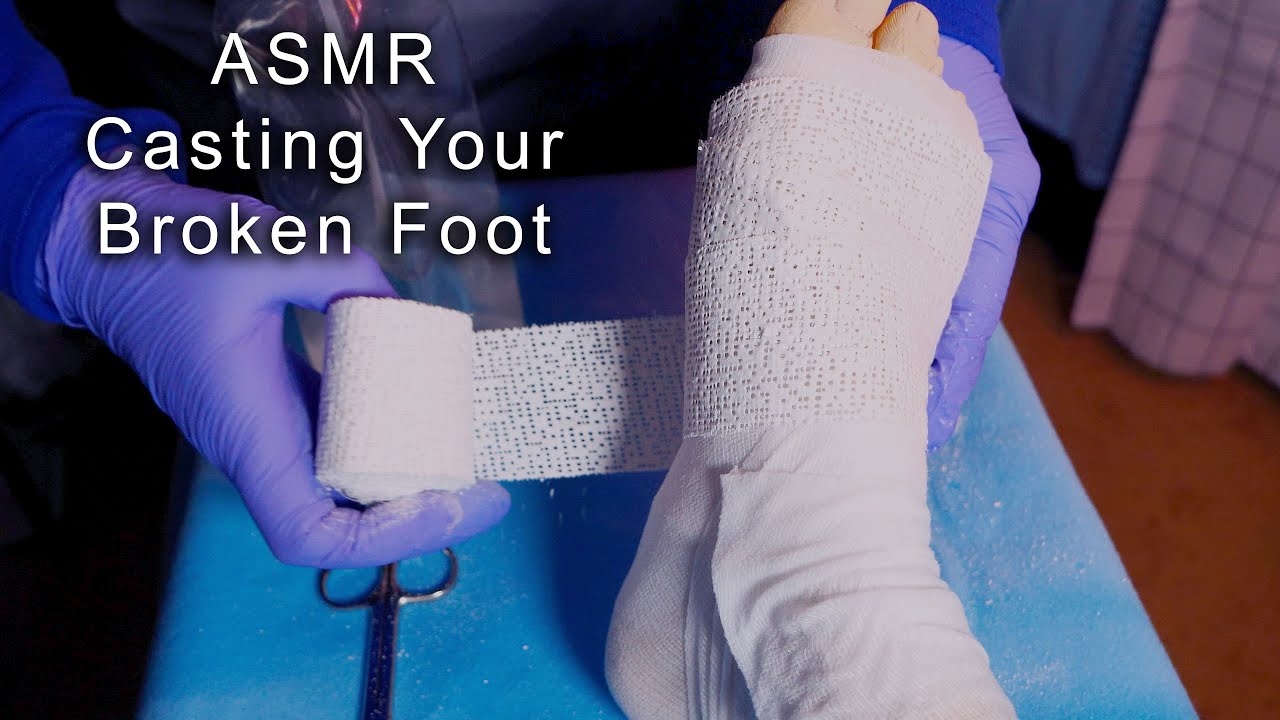 ASMR Hospital Placing a Cast on Your Broken Foot | Medical Role Play