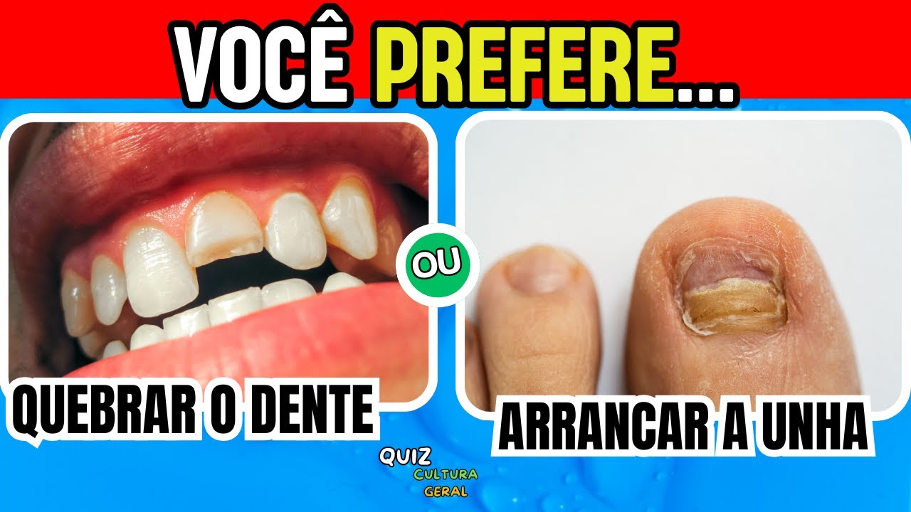 O QUE VOCÊ PREFERE...? 🤔 20 Escolhas Bem DIFÍCEIS! 😱🔥 Faça a Sua Escolha! 🎯