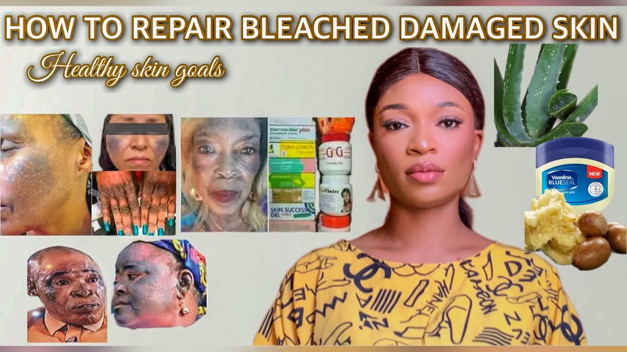 HOW TO REPAIR A BLEACHED DAMAGED SKIN| products to use after skin bleaching for a healthy skin