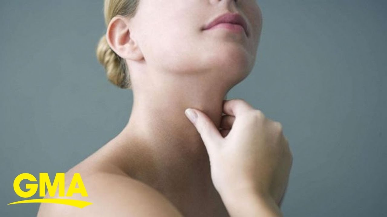 Thyroid Cancer Awareness Month: How to check for the increasingly occurring disease | GMA Digital
