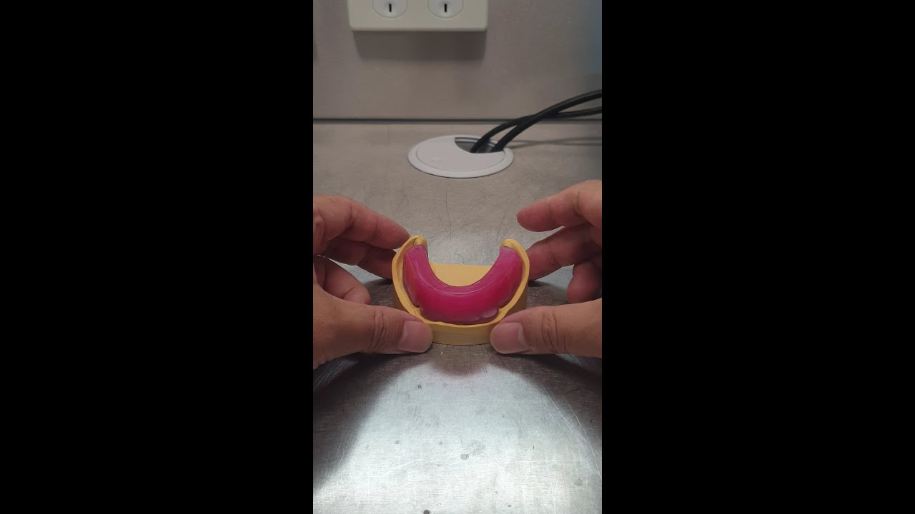 Fabrication of bite registration rim for full mandible arch with light-cure base