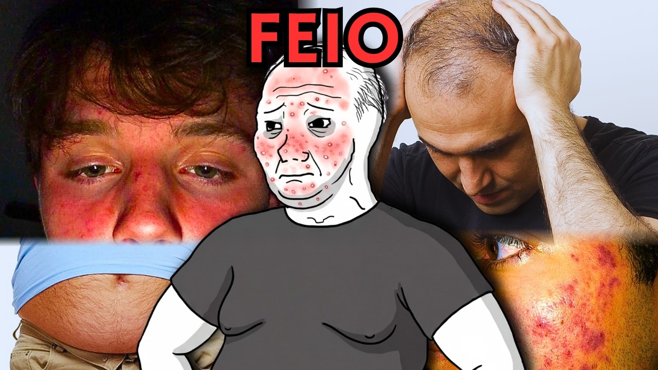 Esse HORM&Ocirc;NIO te deixa MAIS FEIO