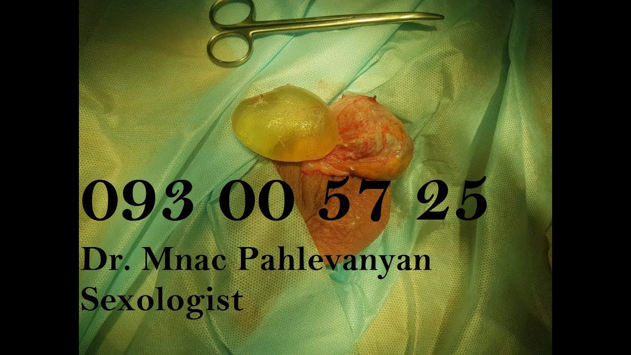 Կիստաներ, դրանց կլինիկական նշանակությունը