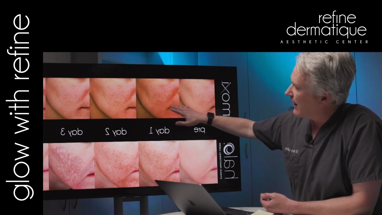 Glow With Refine | BBL HERO, Halo, and Moxi | Aesthetic Laser Treatments