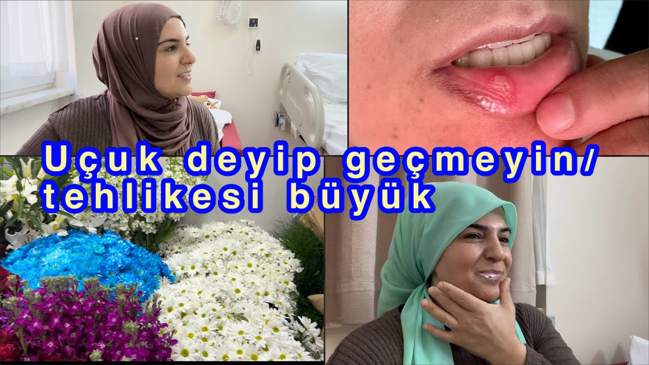 Ufak bir uçuk her şeyi iptal etti/ameliyatlar ertelendi çok tehlikeli komaya gire bilirsin dedi Dr..