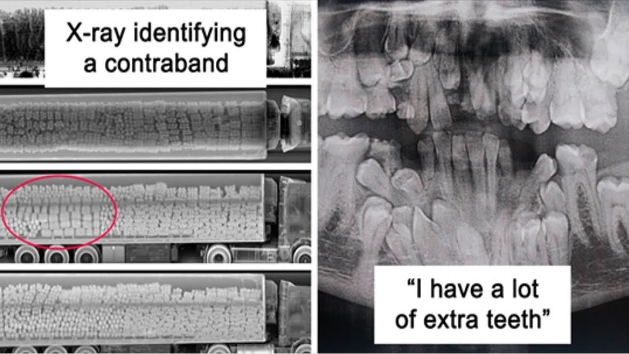 Times People X Rayed Things And Got Interesting Results | Memes Time