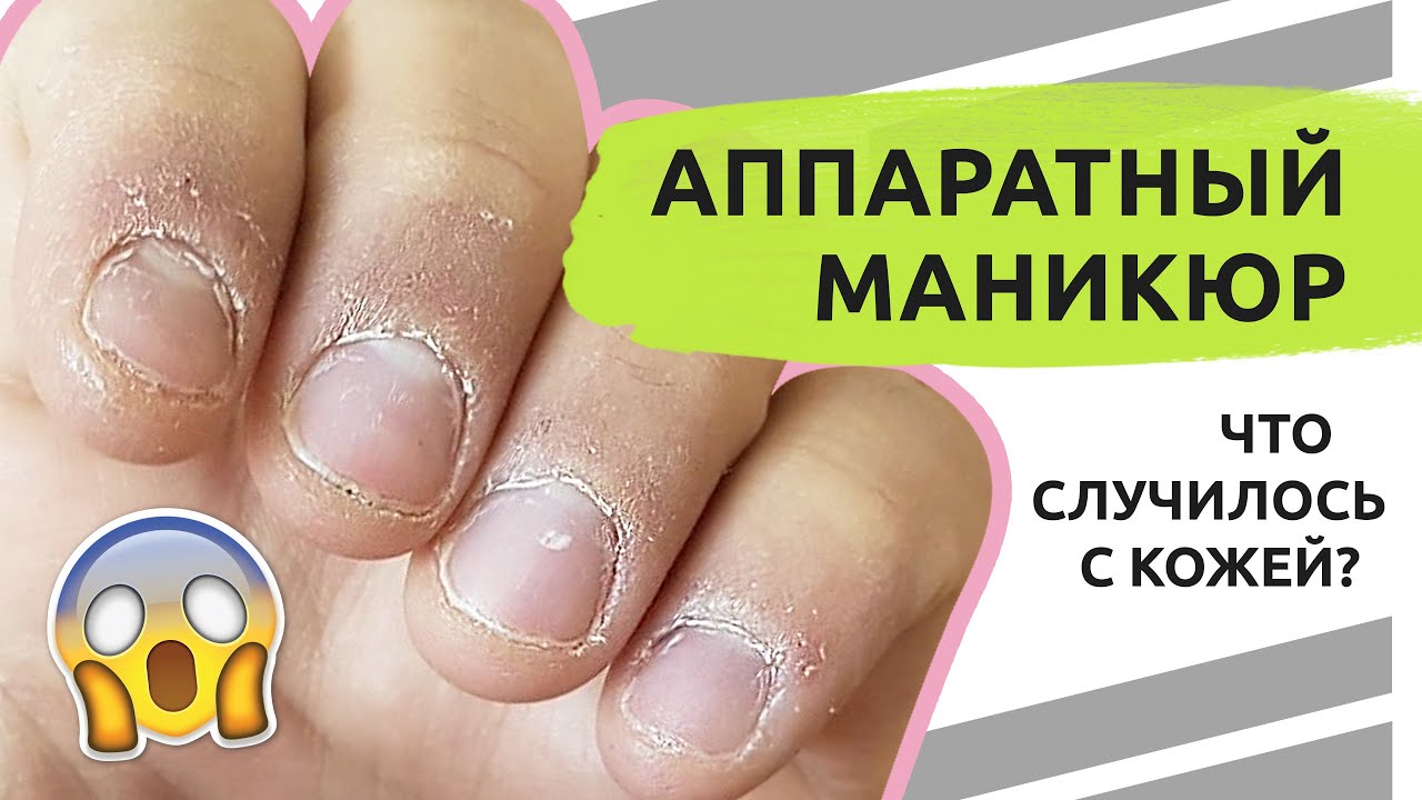 Что СЛУЧИЛОСЬ с кожей? Аппаратный маникюр