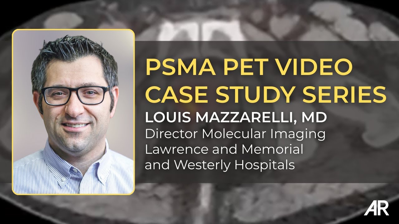 Introduction | Foundations of PSMA PET with Louis Mazzarelli, MD
