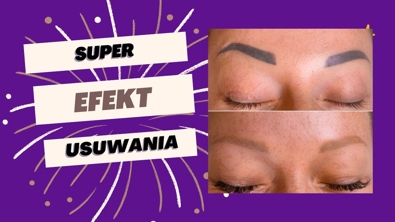 Laserowe usuwanie makijażu permanentnego brwi