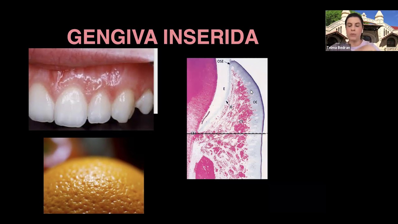 17/03/2021 - Anatomia Peri-Implantar e Tipos de Implantes